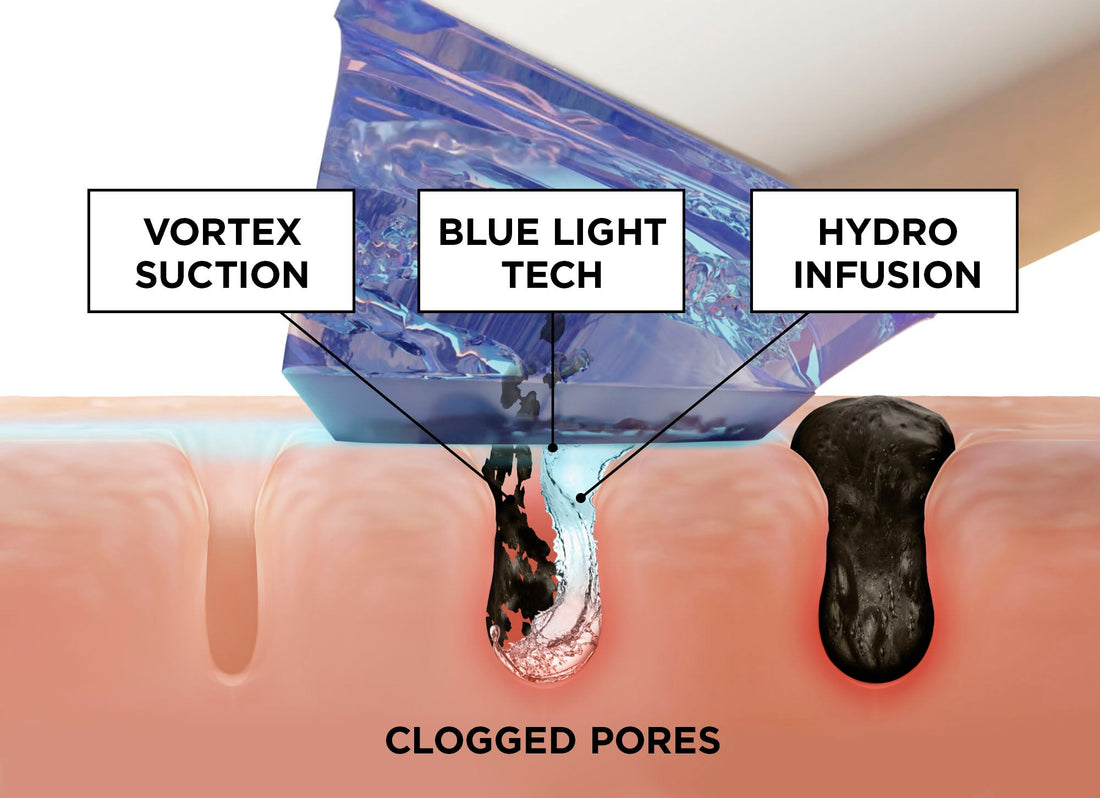 At-Home Treatments: GLOfacial vs. The “Other Guys”