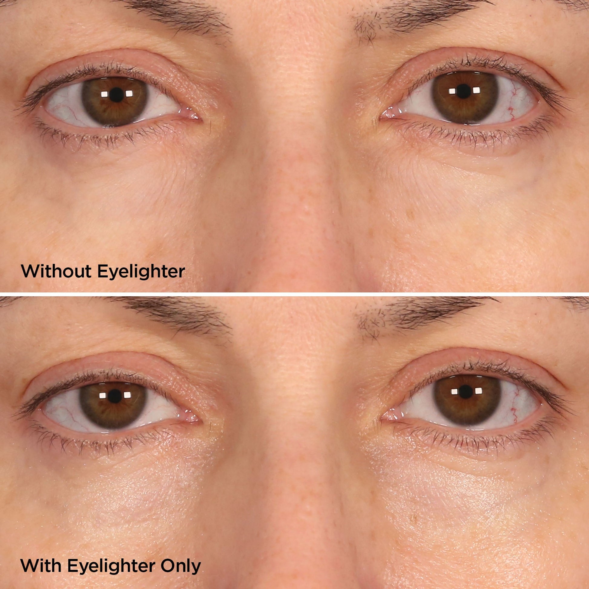 The Eyelighter Concentrate Skincare BeautyBio 