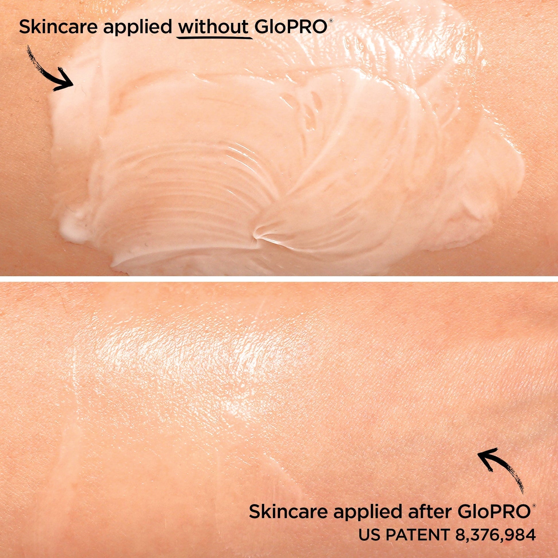 GloPRO® At-Home Microneedling Tool GloPRO BeautyBio 